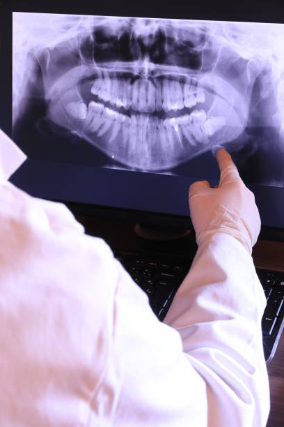 Best Emergency Dentist for Lost Fillings or Crowns in Morgantown, IN