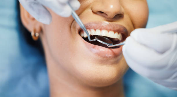 Best Emergency Dental Services for Seniors in Morgantown, IN